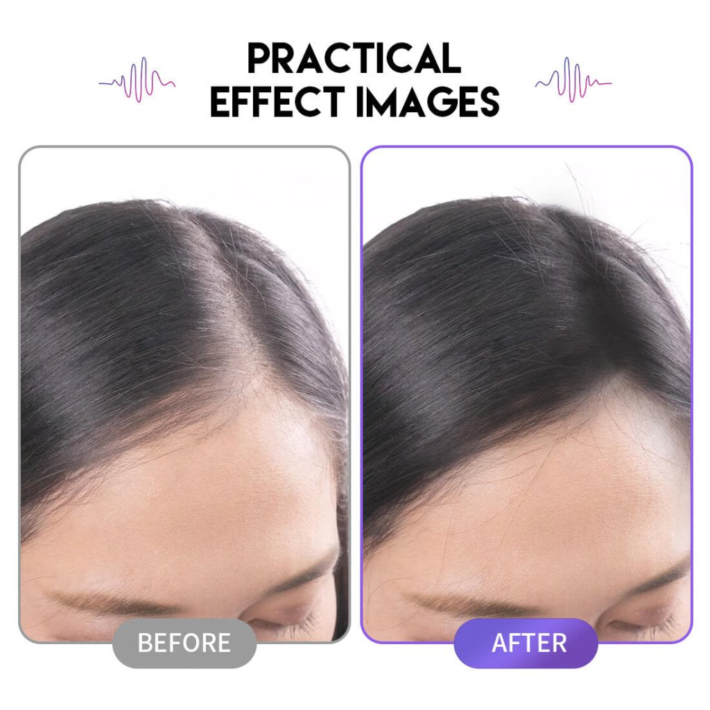 Mast Pro New Generation 2P Tattoo Cartridge Needles – Box of 20