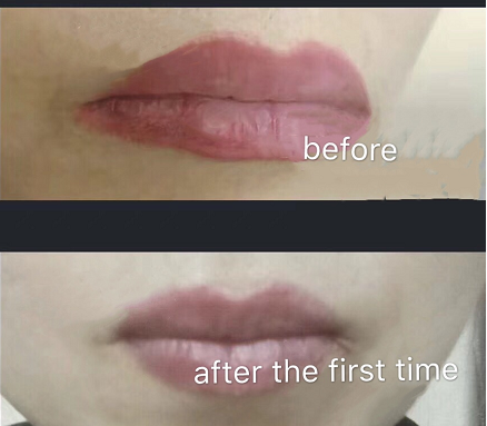 Permanent Makeup PH7 Pigment Removal Solution