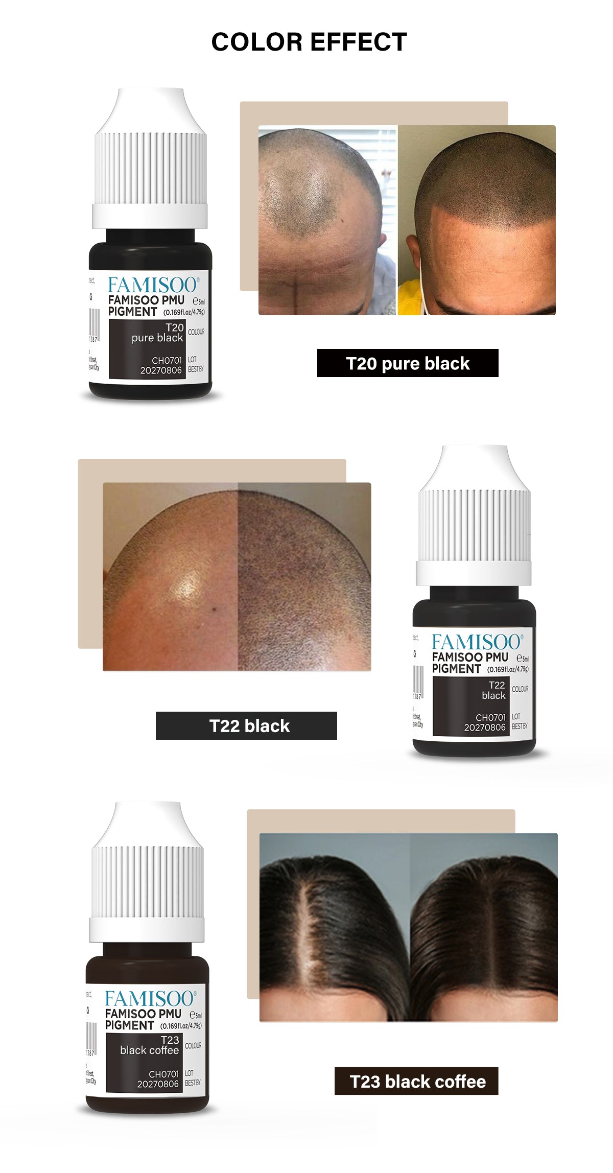 FAMISOO 5ML SMP Scalp Pigments – 4 Shades for Natural Hairline Restoration