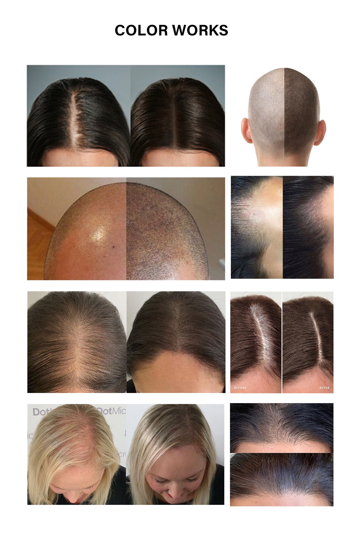 FAMISOO 5ML SMP Scalp Pigments – 4 Shades for Natural Hairline Restoration
