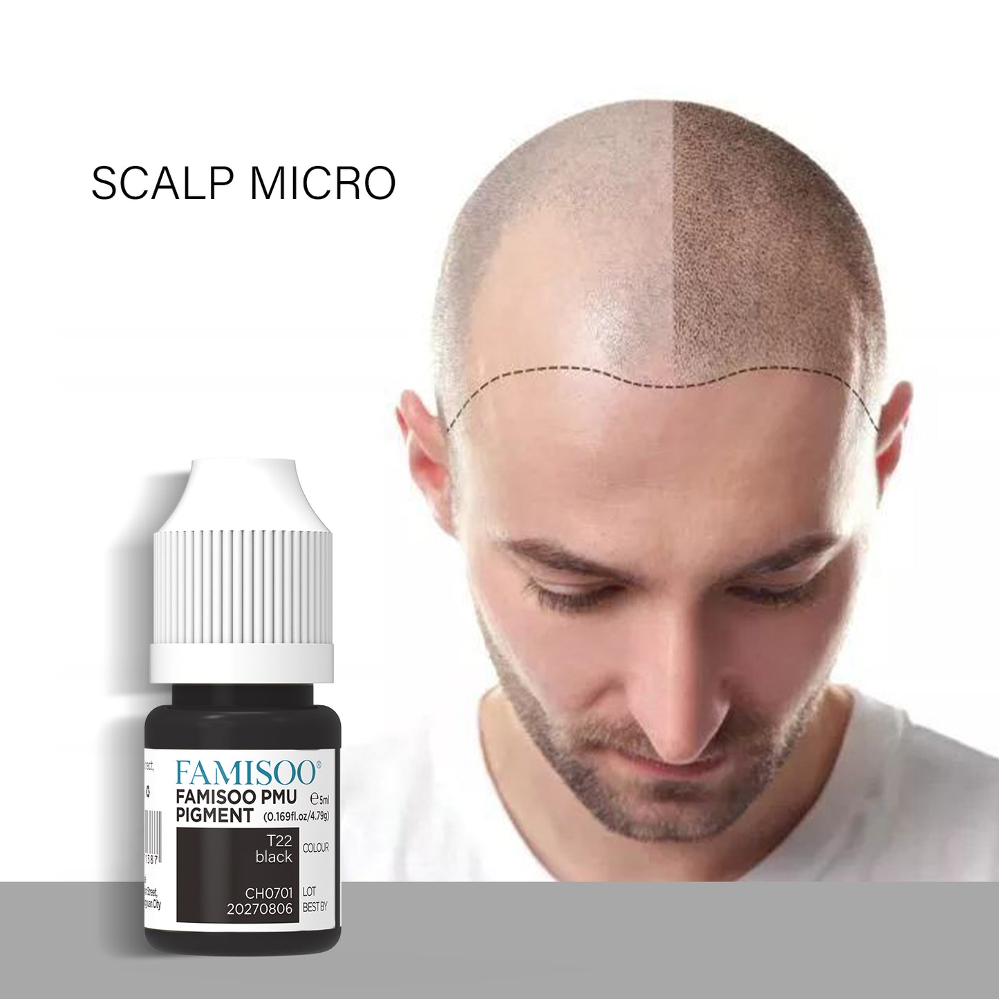 FAMISOO 5ML SMP Scalp Pigments – 4 Shades for Natural Hairline Restoration