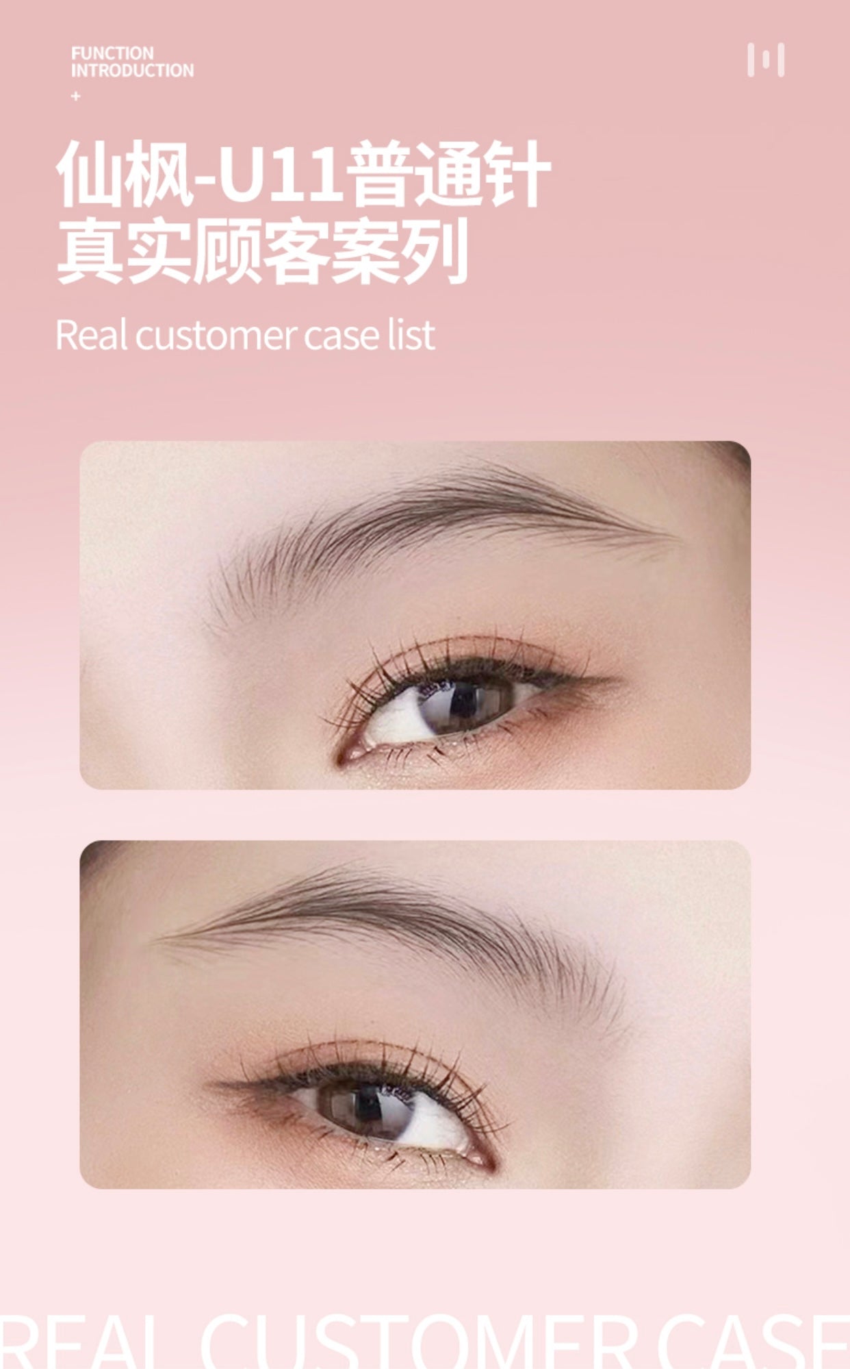 XF Regular U14 Special PMU Needle - 10PCS/Box (For Use Only with XF Machines – Not Compatible with Other Devices)