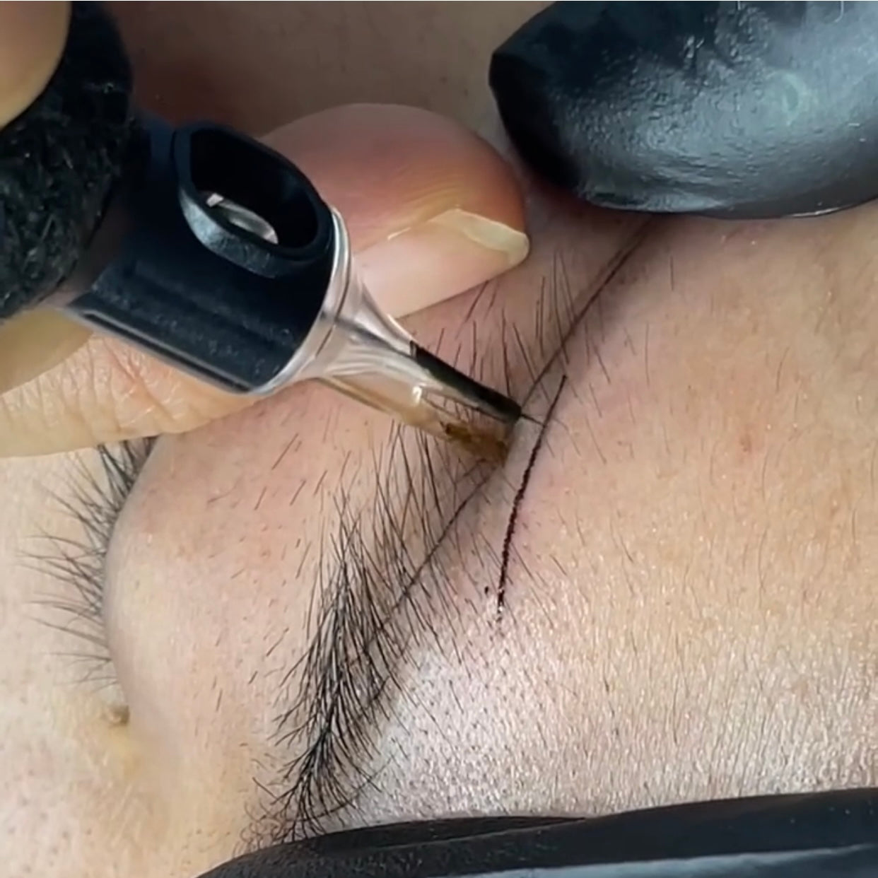 Precision Glide Support Needle – Single Needle Cartridge (10pcs/Box)