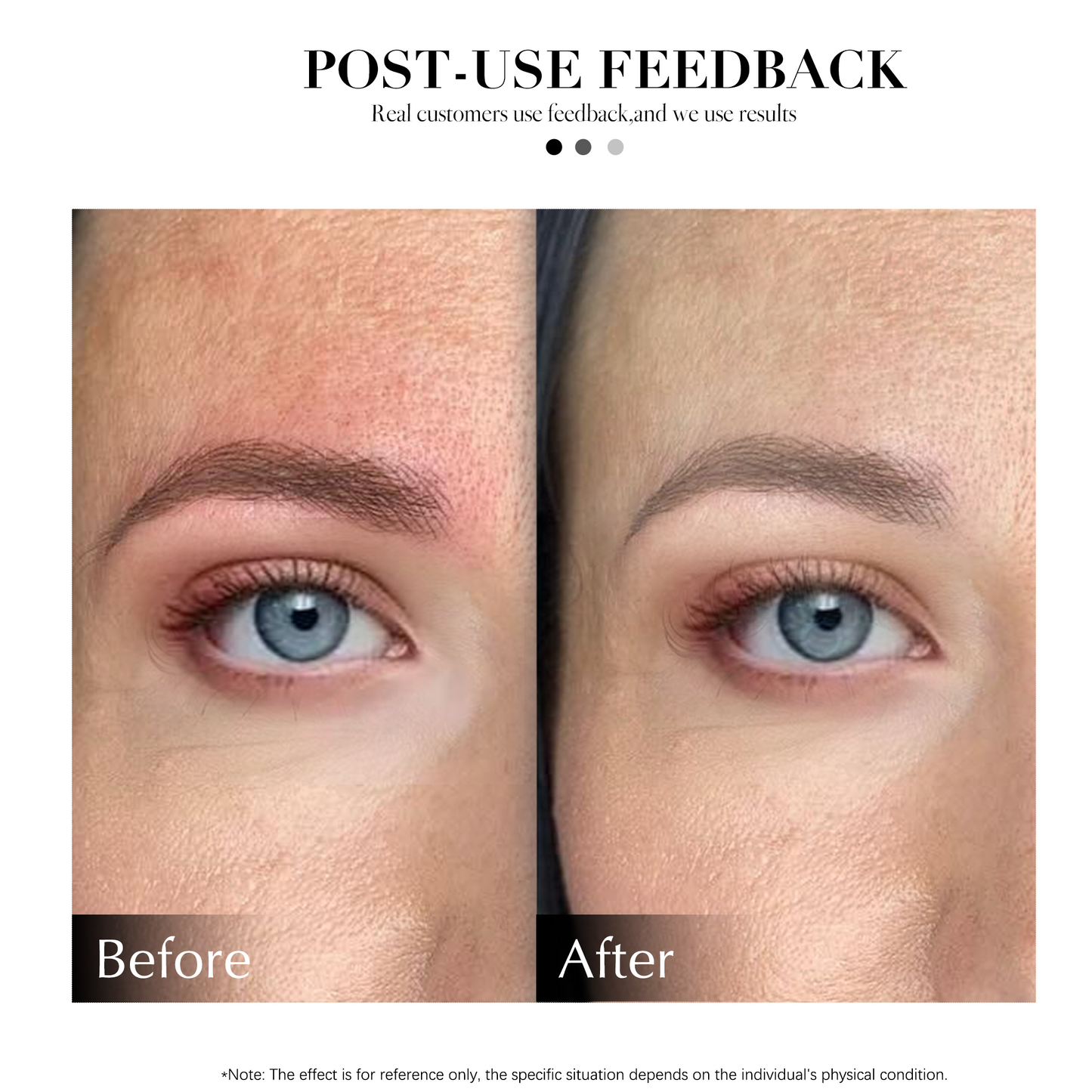 Calming Gel (Red-Bye-Bye) – Post-Microblading Skin Relief