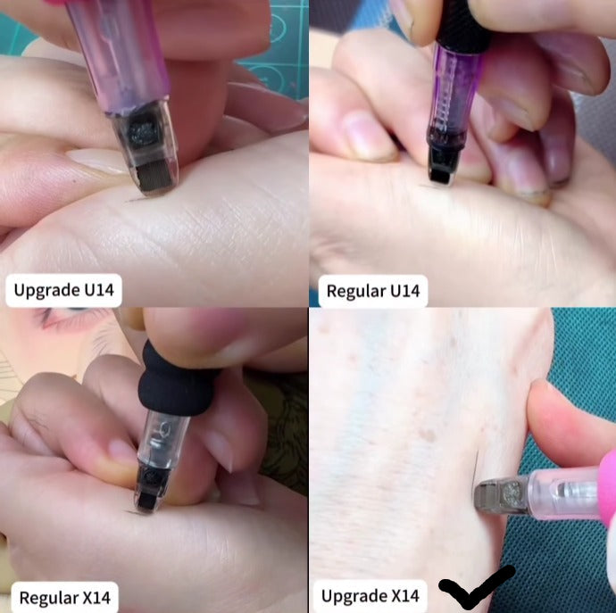 XF Upgrade XU14 Special PMU Needle - 10PCS/Box (For Use Only with XF Machines – Not Compatible with Other Devices)