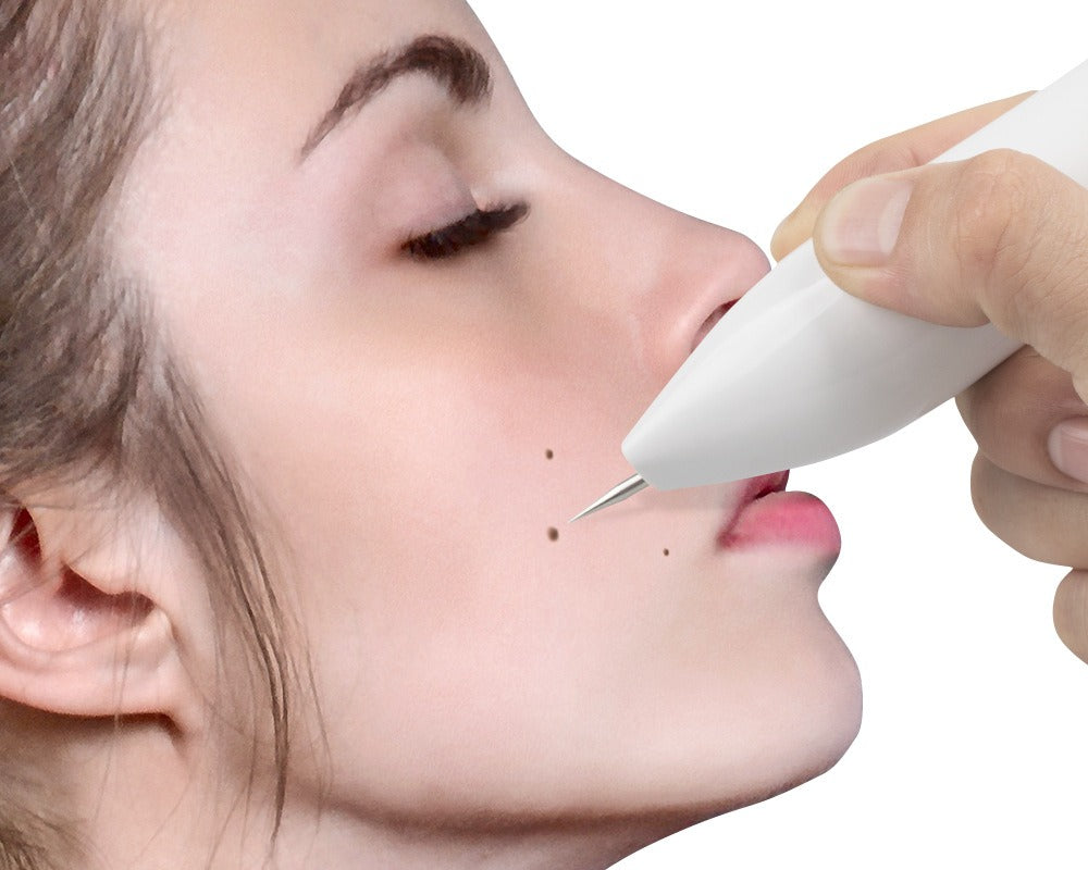 Digital Beauty Mole Removal Pen – Multi-Level Spot & Skin Treatment Tool