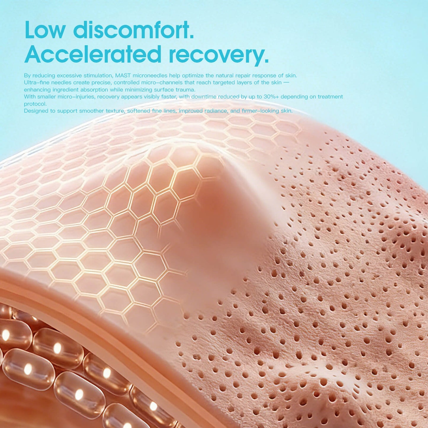 MAST Micro Needle Cartridges – Professional Microneedling Needles for Skin Rejuvenation