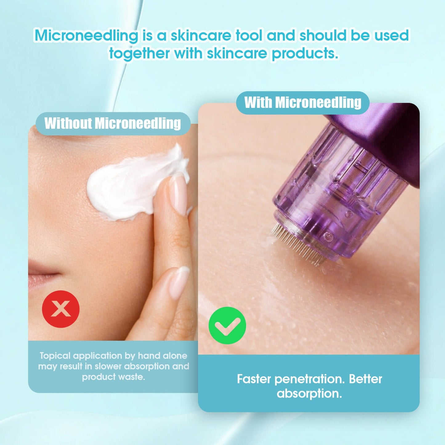 MAST Micro Needle Cartridges – Professional Microneedling Needles for Skin Rejuvenation