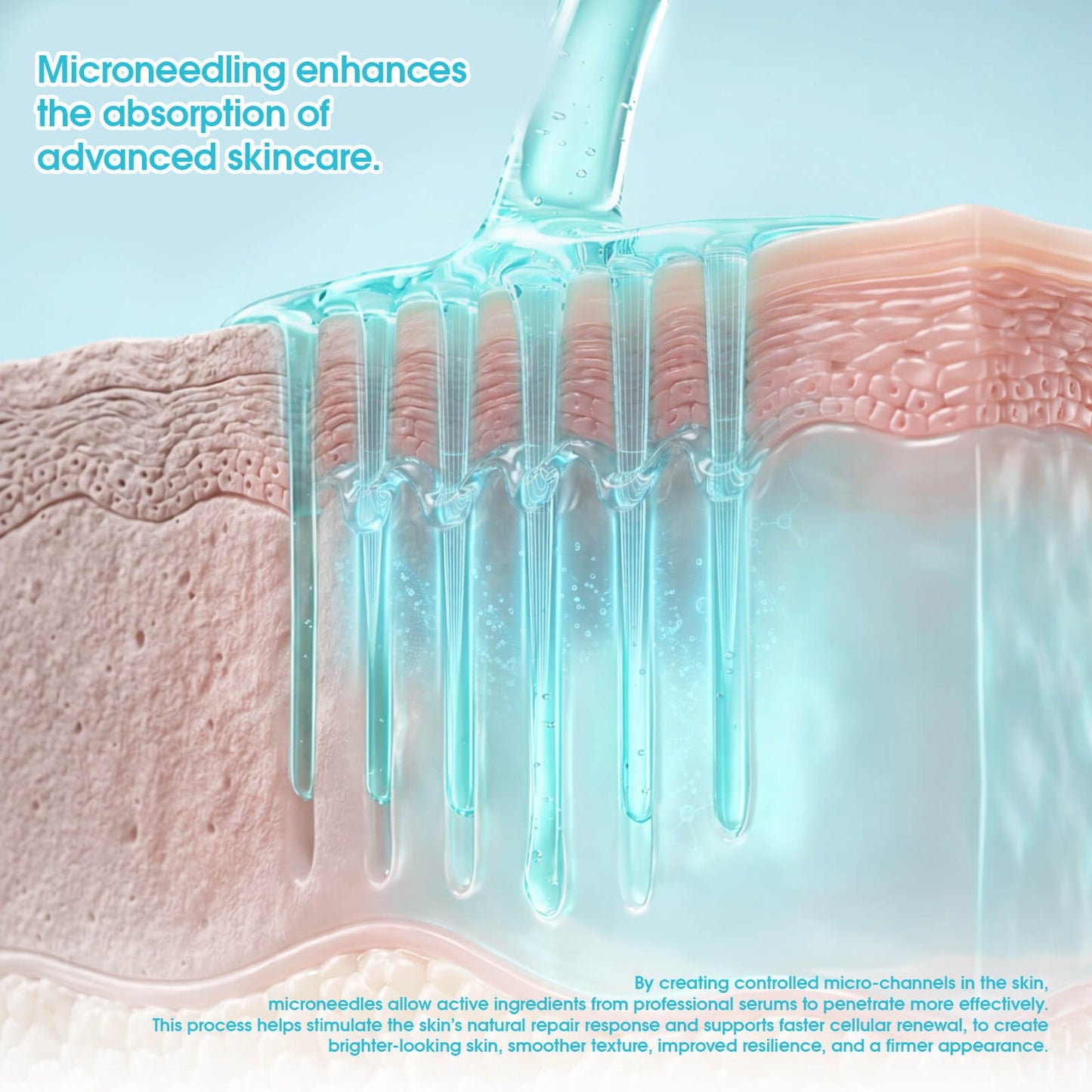 MAST Micro Needle Cartridges – Professional Microneedling Needles for Skin Rejuvenation