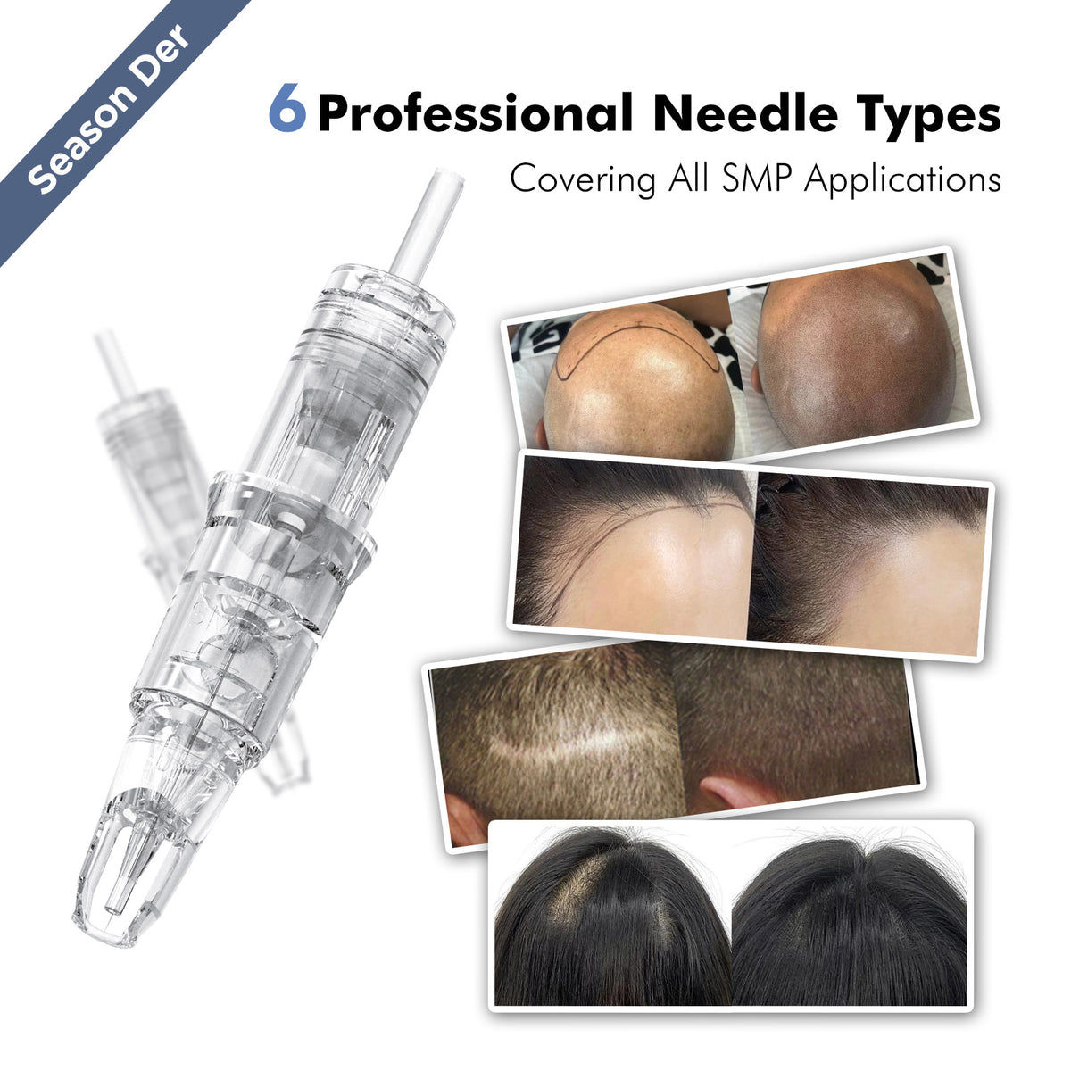 V6 SMP Needle Cartridges – Patented Detachable Positioning Tip Sleeve, 10PCS/Box
