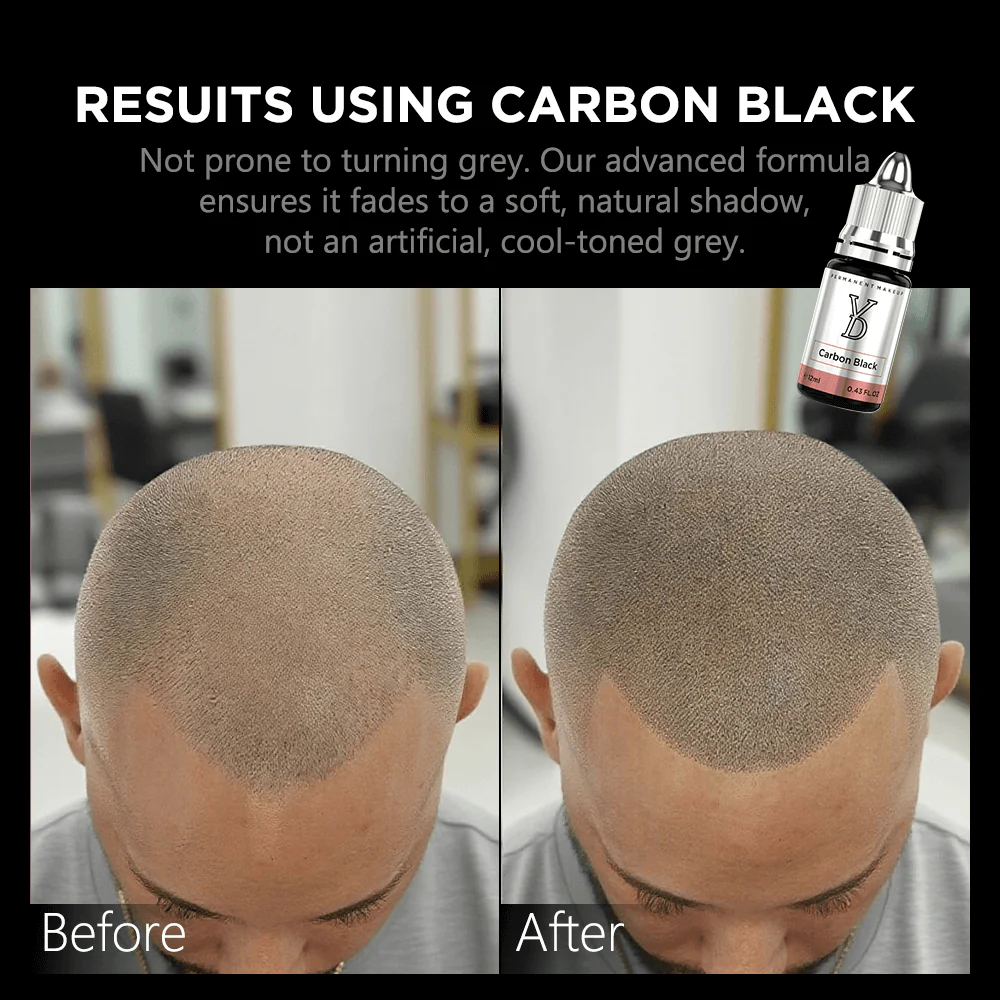 YD POWDER Hybrid Liquid Pigment for Scalp Micropigmentation (SMP)
