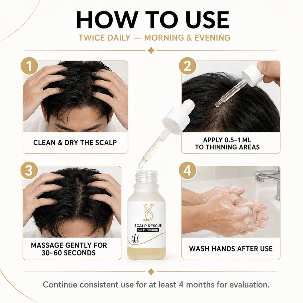 YD Scalp Rescue 5% Minoxidil Hair Regrowth Treatment – 15ml