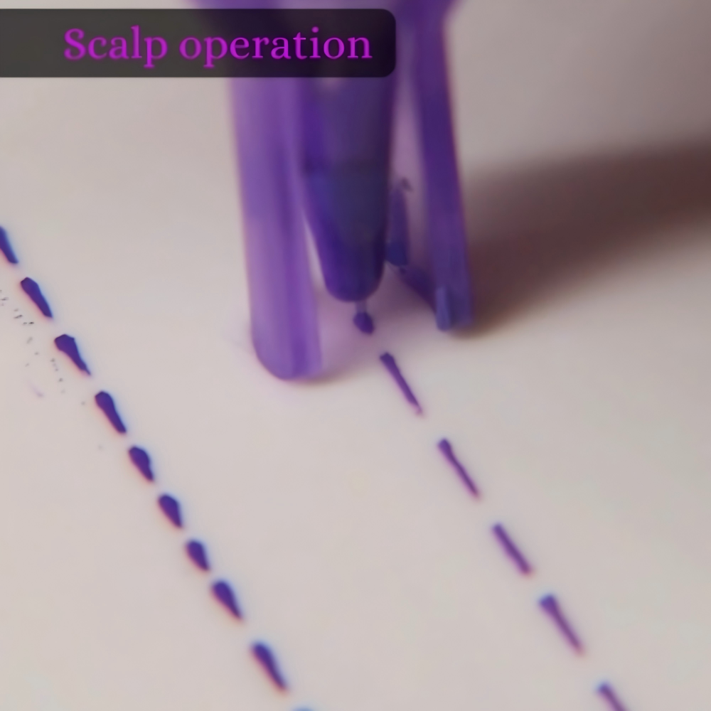 YD Purple Scalp Needle SMP Cartridges with Guard | 20 PCS / Box